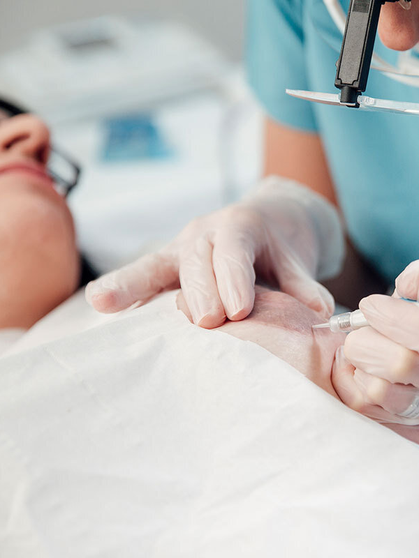 Micropigmentación de areola mamaria en Tenerife, tras una mastectomía, una cirugía, un accidente, para difuminar cicatrices y estrias