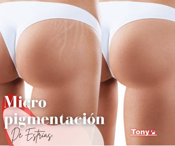 micropigmentación especializada para difuminar cicatrices en Tenerife